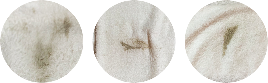 ストーンセラピー細胞浴で使用した施術後のタオルの様子